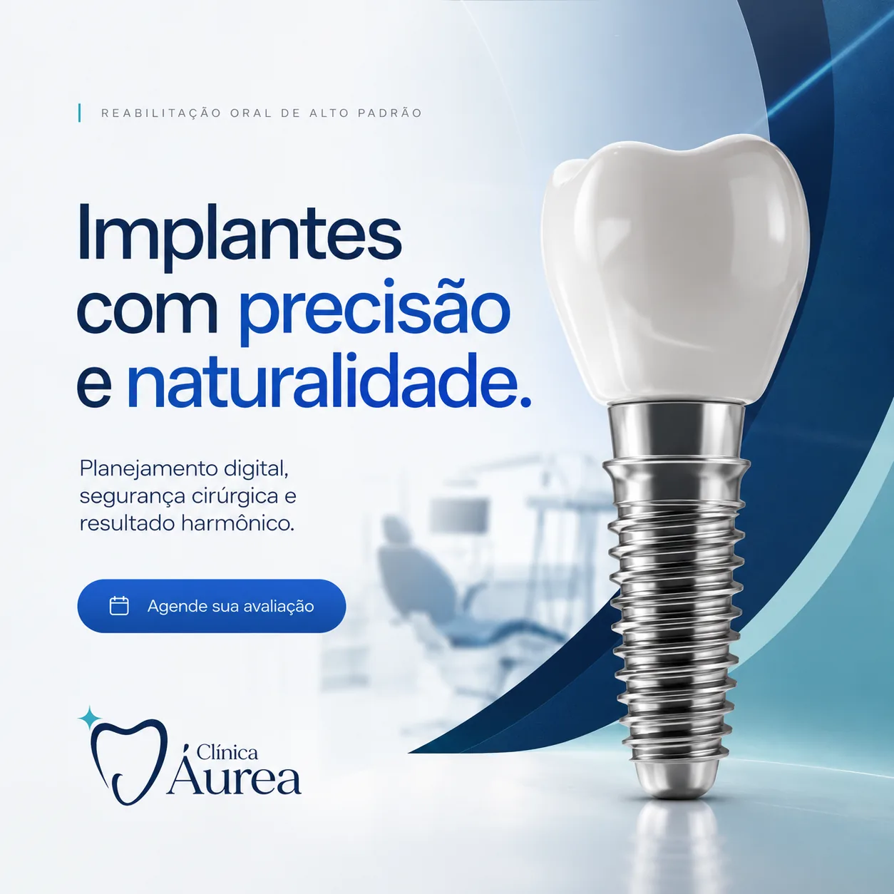 Post odontológico sobre implantes com precisão e naturalidade